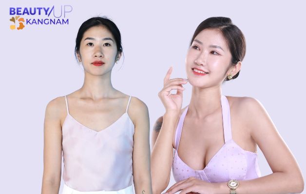 Mẹ bỉm 9x thẩm mỹ để thoát khỏi vùng an toàn