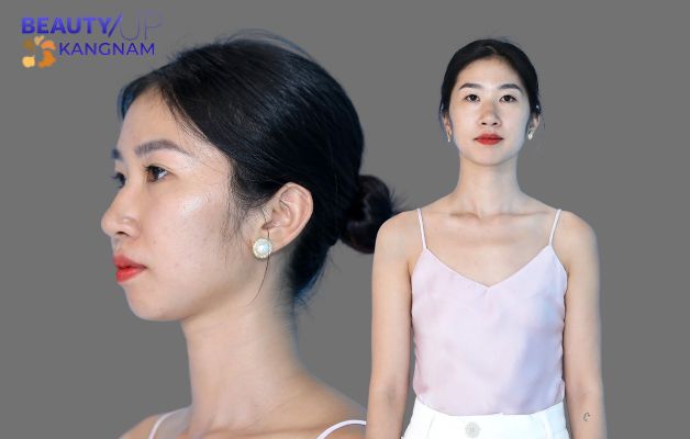 Vòng 1 teo lép khiến Thùy Dương cảm thấy mặc cảm