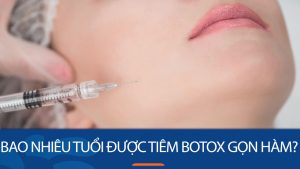 Bao nhiêu tuổi được tiêm botox gọn hàm? Giải đáp thắc mắc từ chuyên gia