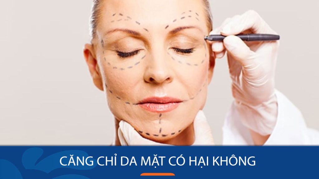 Căng chỉ da mặt có hại không? Lợi ích, tác hại và lưu ý quan trọng