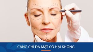 Căng chỉ da mặt có hại không? Lợi ích, tác hại và lưu ý quan trọng