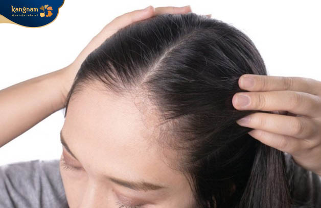 Tình trạng rụng tóc