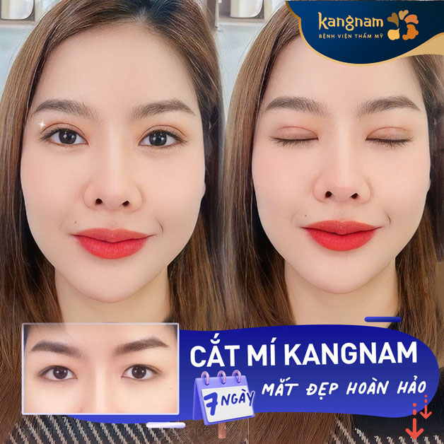 Mí xinh hoàn hảo sau khi đã ổn định