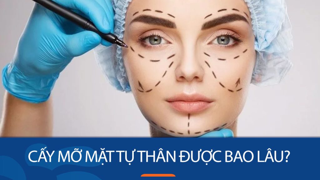 Cấy mỡ mặt tự thân được bao lâu? 5 cách duy trì vẻ đẹp thẩm mỹ