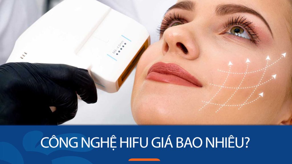 Giá Hifu mới nhất – Chi tiết chi phí từng vùng điều trị