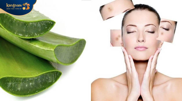 Nha đam chứa nhiều vitamin tốt cho quá trình trị sẹo rỗ và dưỡng ẩm