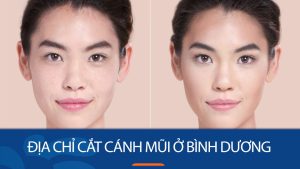 Địa chỉ cắt cánh mũi kangnam Bình Dương – Dáng mũi cân đối, tự nhiên