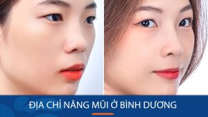 Nâng mũi kangnam Bình Dương giúp bạn sở hữu dáng mũi cao, đẹp tự nhiên!