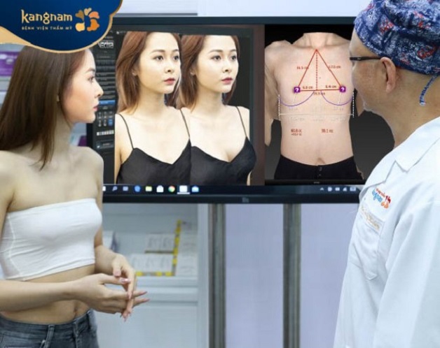 Viện thẩm mỹ Kangnam Bình Dương là địa chỉ nâng ngực uy tín tại khu vực Bình Dương