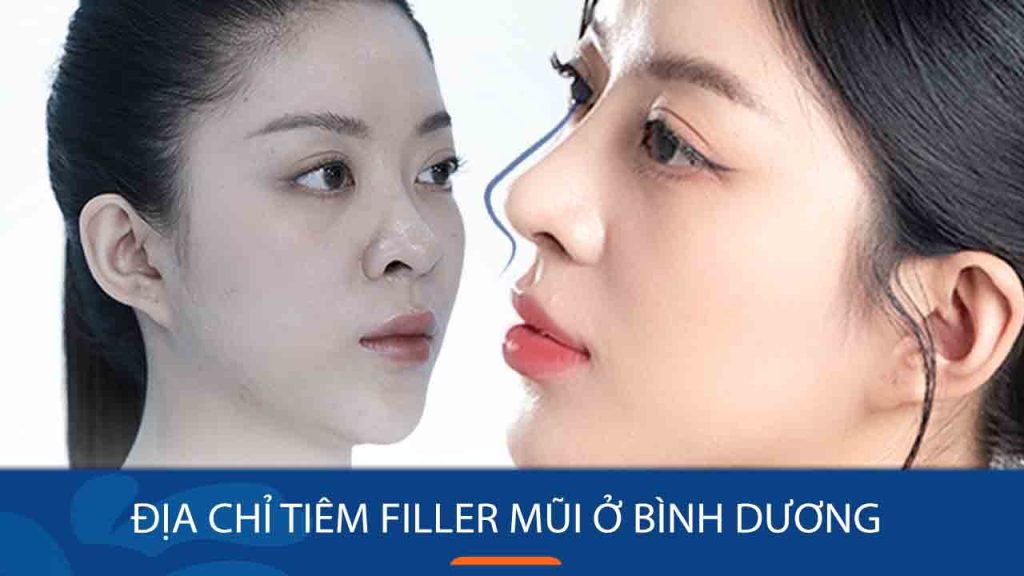Địa chỉ tiêm filler mũi ở Bình Dương – Thiết kế dáng mũi cao, thanh thoát