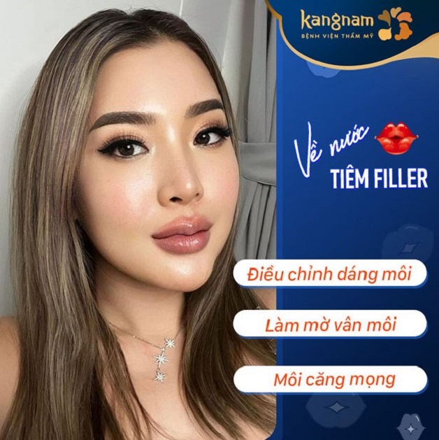 Dịch vụ tiêm filler môi tại Kangnam Bình Dương