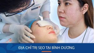 Trị Sẹo Tại Kangnam Bình Dương: Công Nghệ Hiện Đại, Hiệu Quả Nhanh Chóng