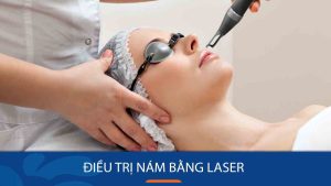 Review điều trị nám bằng laser: các công nghệ tân tiến nhất
