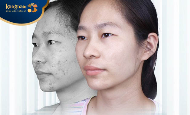 Xây dựng phác đồ điều trị cá nhân hóa, chuyên sâu để mang lại hiệu quả tối ưu nhất