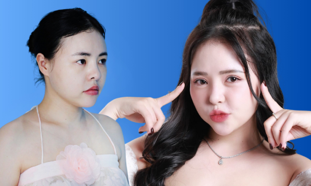 Streamer Hà Thành hóa “tiên nữ” giữa đời thực sau khi cắt mí