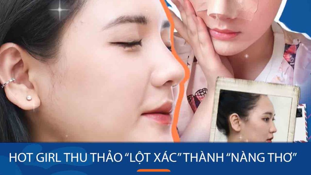 Hot Girl 2k1 “lột xác” thành “nàng thơ” nhờ nâng mũi