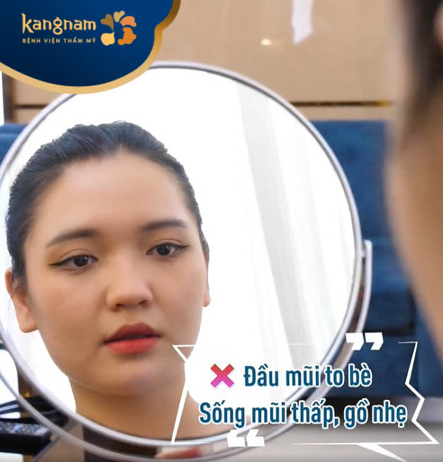 Mũi của Thu Thảo trước khi nâng