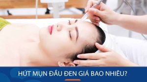 Hút mụn đầu đen giá bao nhiêu? Các yếu tố ảnh hưởng đến giá