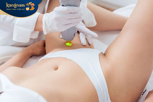 Liệu trình triệt lông bikini bao lâu