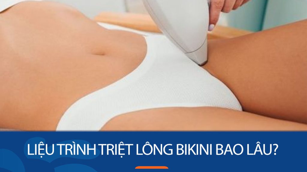 Liệu trình triệt lông bikini 6 buổi – Nhanh chóng, hiệu quả, lâu dài