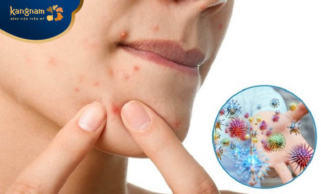 Rối loạn nội tiết tố là một trong những nguyên nhân chính gây mụn ẩn ở quanh vùng miệng