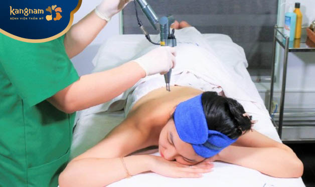 điều trị bằng laser hiện nay vẫn được xem là tân tiến nhất giúp trị mụn viêm nang lông nhanh chóng