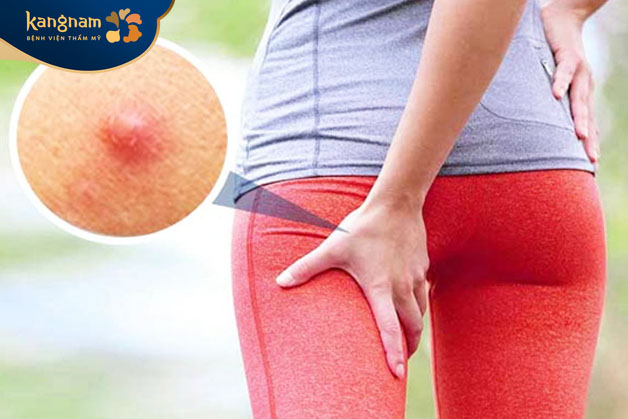 Thay đổi nội tiết tố