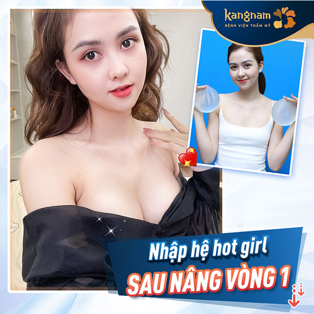 Mẹ 1 con xinh như hot girl sau khi trùng tu vòng 1