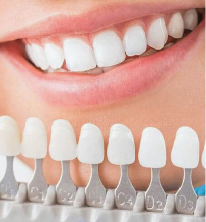 Chuyên khoa Nha khoa Thẩm mỹ tại Bệnh viện Thẩm mỹ Kangnam