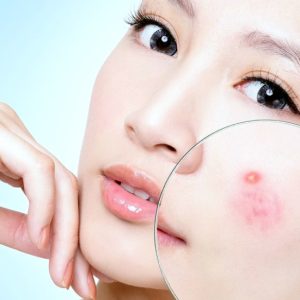 Chuyên khoa da liễu & điều trị da công nghệ cao