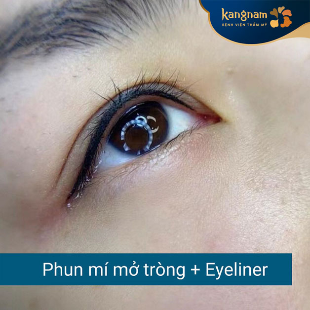 Phun mí mở tròng giúp đôi mắt long lanh, thu hút