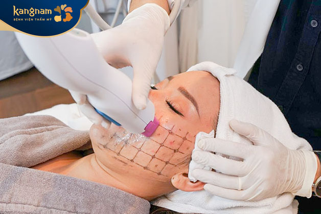 Quy trình trẻ hóa da an toàn của Thermage FLX