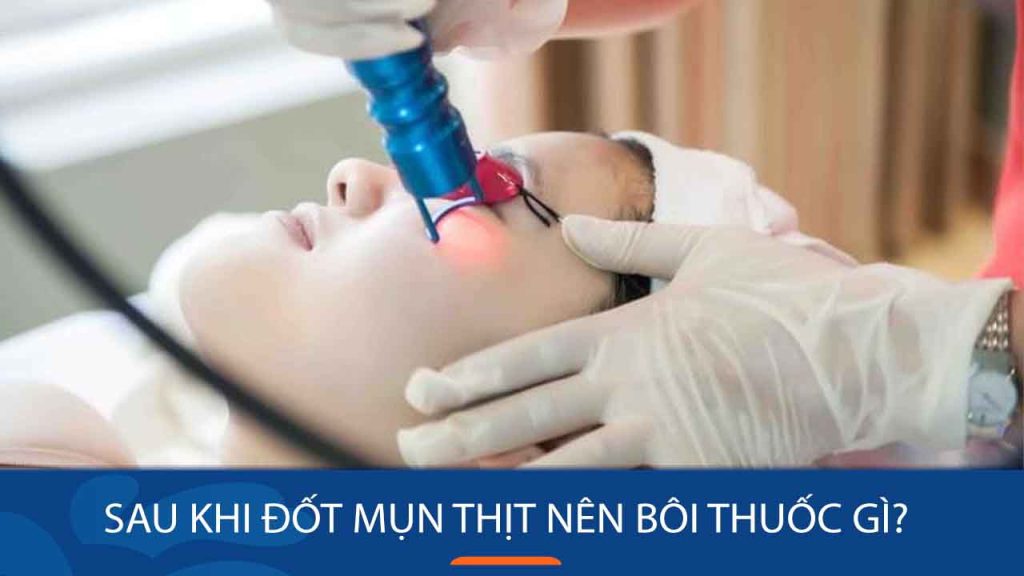 5 Loại Thuốc Bôi Tốt Nhất Sau Khi Đốt Mụn Thịt Giúp Da Mau Lành