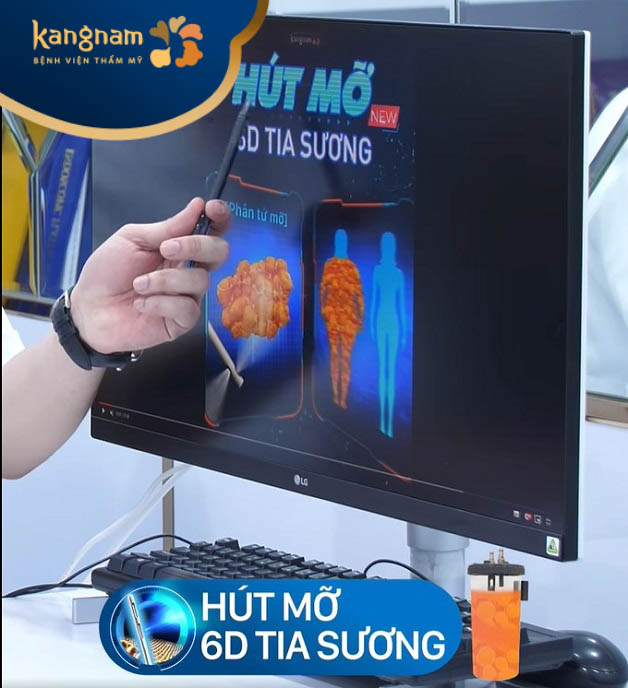 Bác sĩ tư vấn công nghệ hút mỡ không đau tân tiến nhất