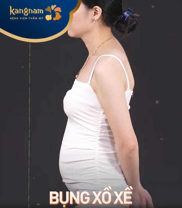 Bà chủ mỹ phẩm Thanh Hằng trước hút mỡ