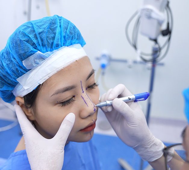 Bác sĩ đo vẽ, đánh dấu vị trí cần thực hiện