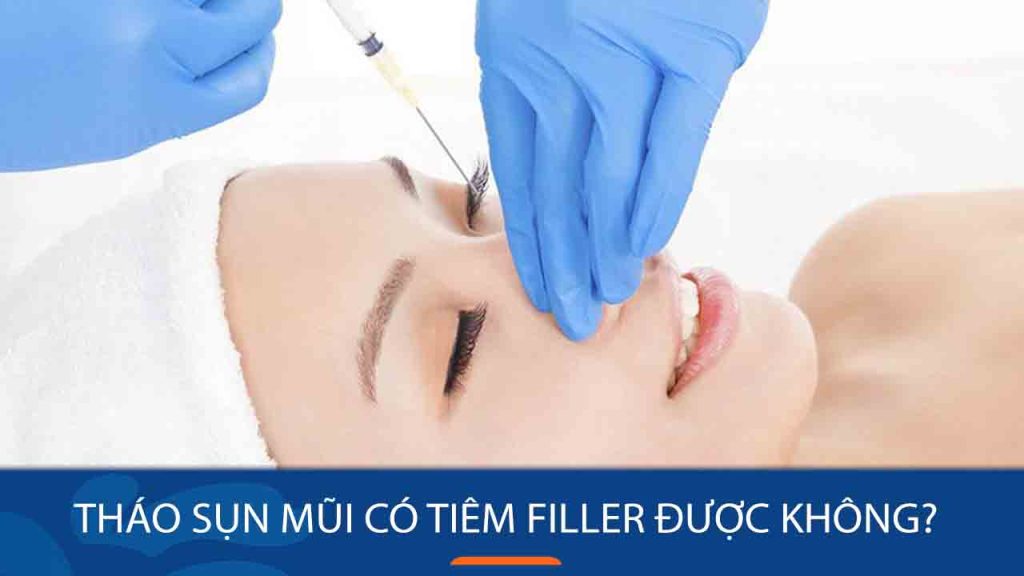 Tháo sụn mũi xong có tiêm filler được không? Lời khuyên từ chuyên gia