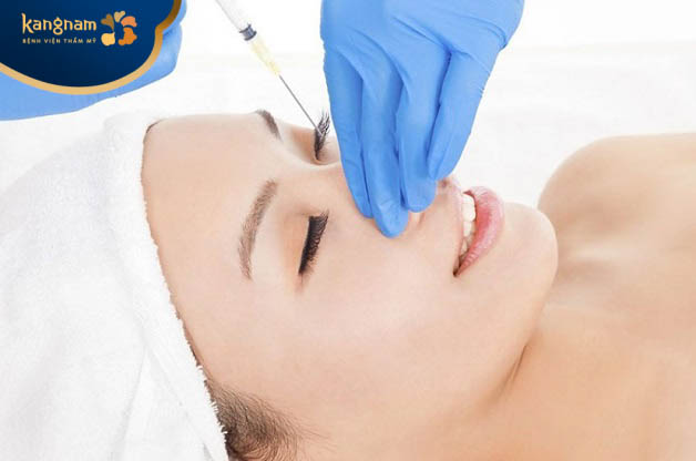 Sau khi tháo sụn mũi, bạn vẫn có thể tiếp tục tiêm filler để cải thiện, nâng cao sống mũi