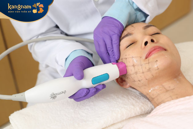 Thermage FLX là phương pháp trẻ hóa da hiệu quả, không đau