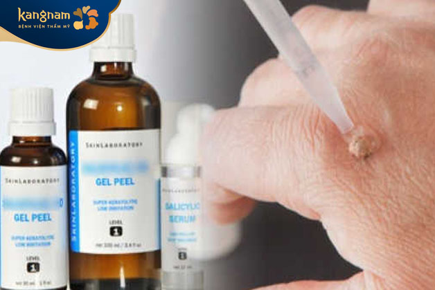 Dùng thuốc bôi trị mụn cóc