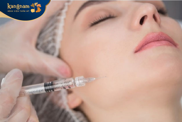 Tiêm botox gọn hàm sau khoảng 3 đến 6 tháng nên thực hiện tiêm lại