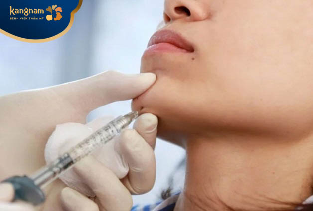 Khi được tiêm filler đúng kỹ thuật, đưa tinh chất đi vào đúng lớp, filler sẽ mang lại hiệu quả lâu dài