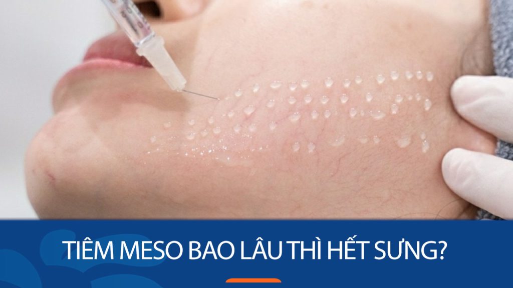 Tiêm meso bao lâu thì hết sưng? Kinh nghiệm giảm sưng hiệu quả