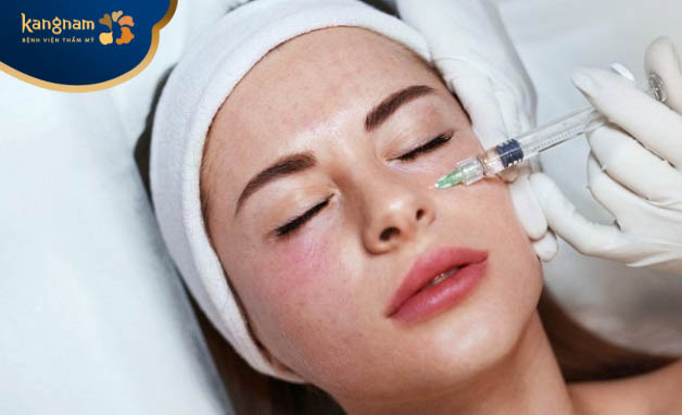 Mục đích tiêm meso khác nhau sẽ tác động đến số lần tiêm meso