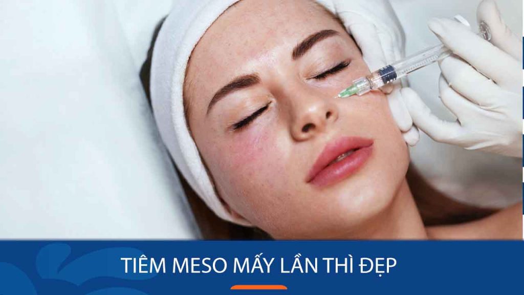 Tiêm meso mấy lần thì đẹp? Tiêm meso nhiều lần có tốt không?