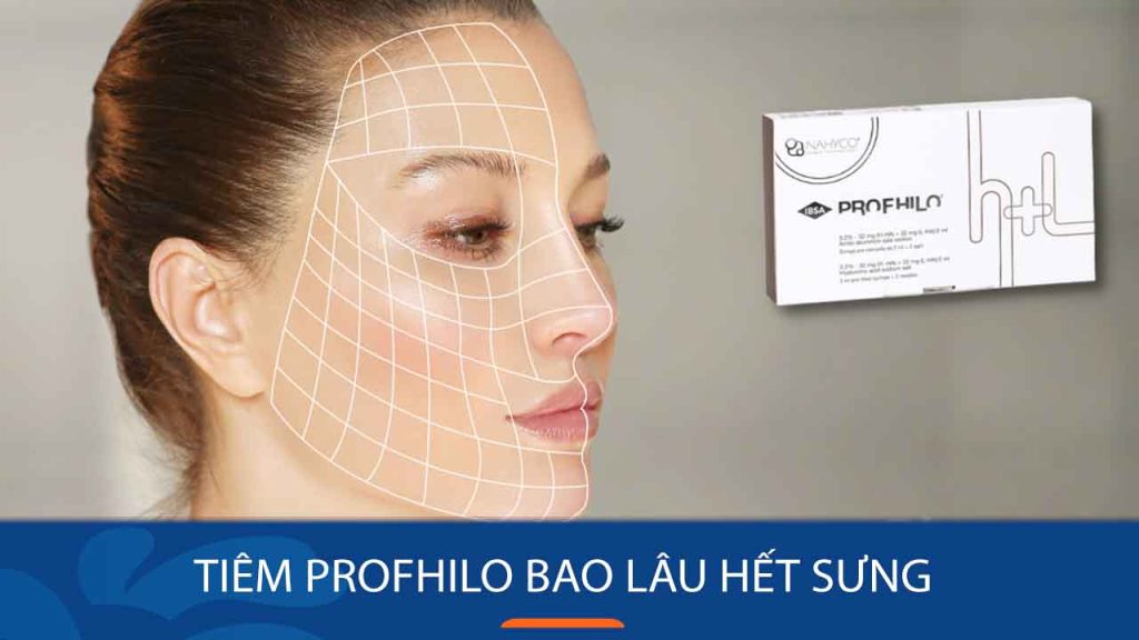 Tiêm Profhilo bao lâu hết sưng? Chia sẻ kinh nghiệm từ người đã trải nghiệm