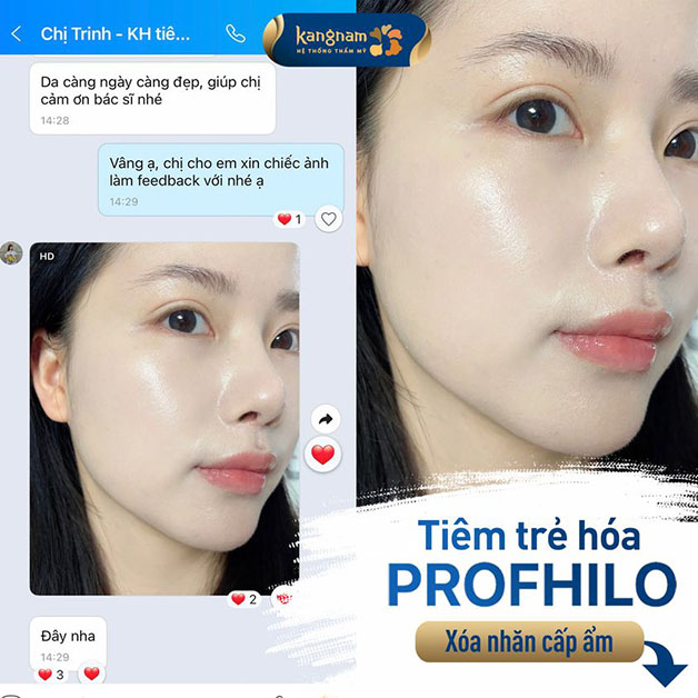 Khách hàng ưng ý sau khi trải nghiệm quá trình trẻ hóa với Profhilo tại Kangnam