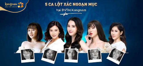 Top 5 ca "lột xác" thành công
