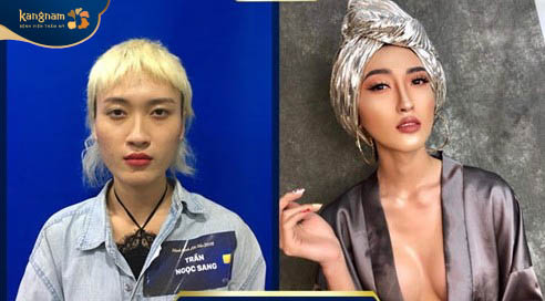 Trần Ngọc Sang với hình hài mới