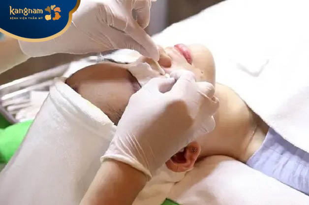 Loại bỏ nhân mụn là bước không thể thiếu trong quá trình điều trị mụn